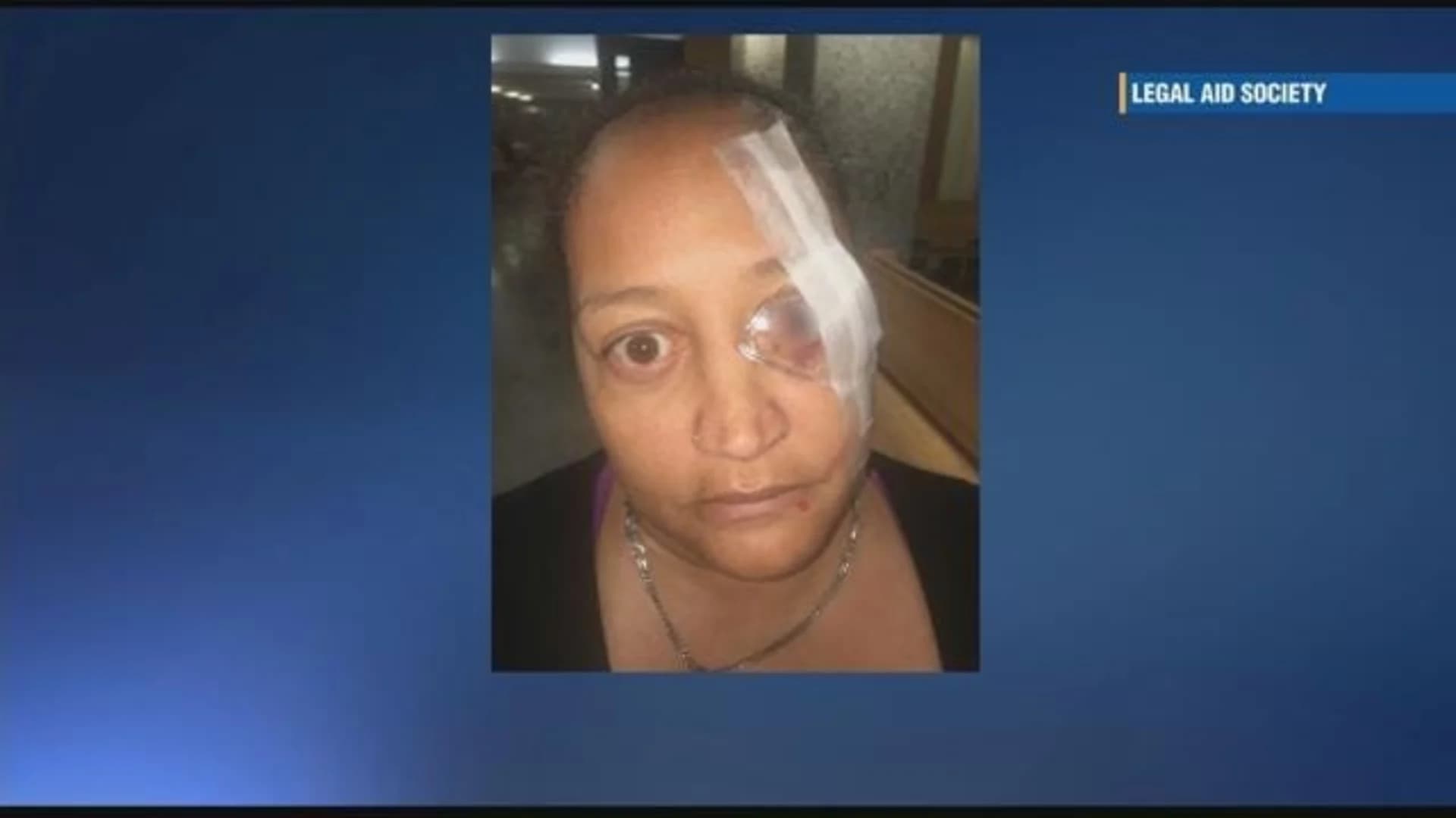 Woman claims altercation with officer knocked eye out of socket