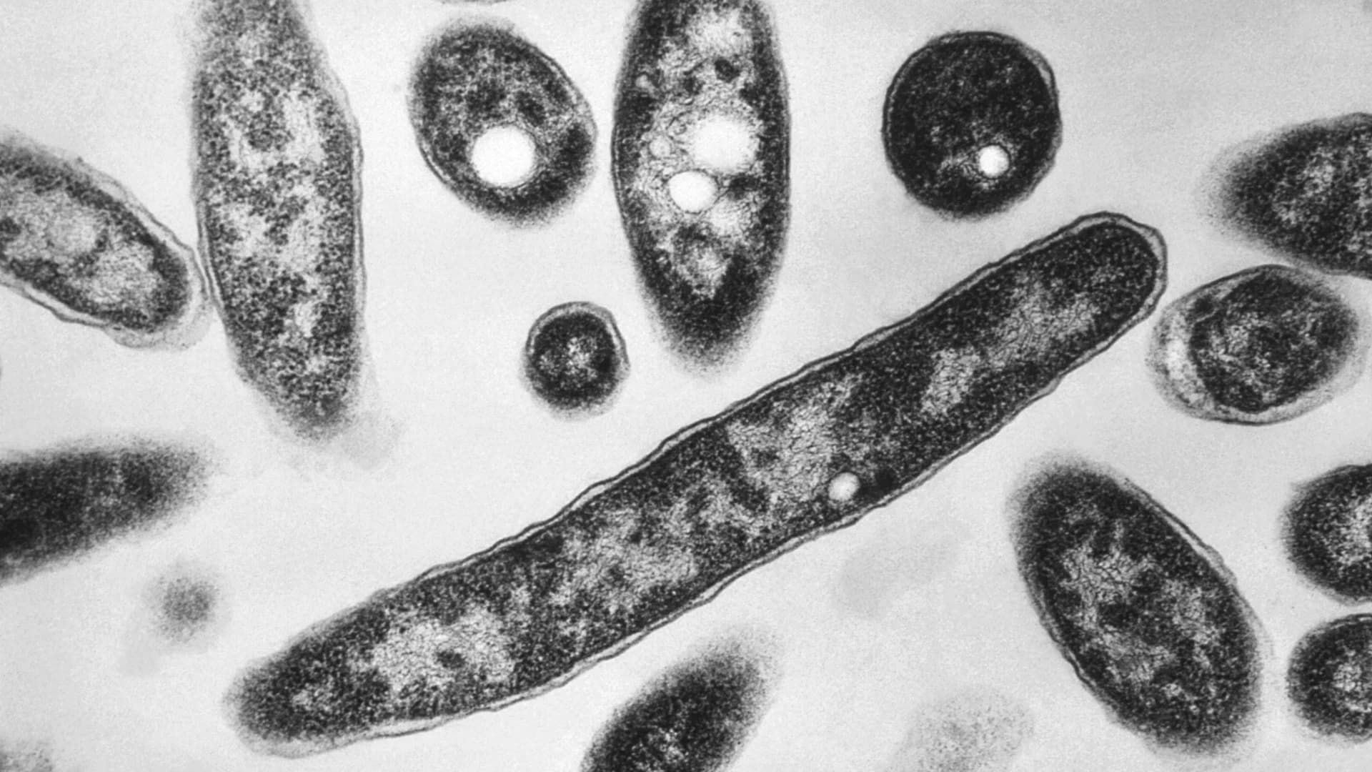 Health officials identify Legionnaires’ disease cluster in the Bronx